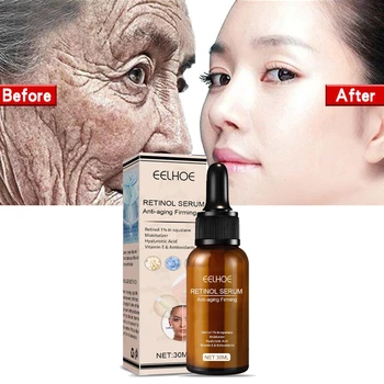Retinol Serum Za Lice Anti-Aging Care Hidratantna Krema Za Izbjeljivanje Uklanja Bore Kozmetika Nestaju Fine Linije Zateže Kožu Kozmetički Proizvod