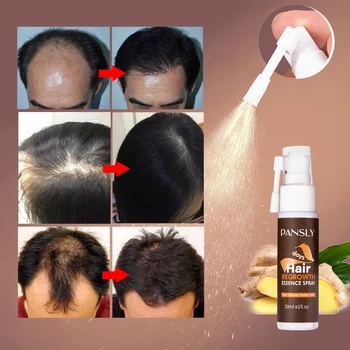 Sprej za rast kose s eteričnim uljima đumbir Sprječava Gubitak kose za sve tipove kose, Brzo liječenje Sprečava Stanjivanje kose Suha Popravak